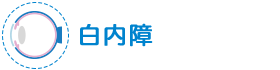 白内障
